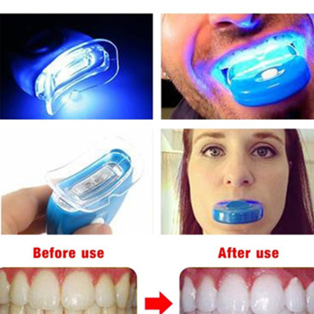 Teeth Whitening Laser Treatment - LED ฟอกสีฟันแสงไวท์เทนนิ่งแสงสีฟ้าแสง UV ฟอกสีฟันเลเซอร์ฟอกสีฟันโคมไฟฟอกสีฟันส่วนบุคคลการรักษาทันตกรรม