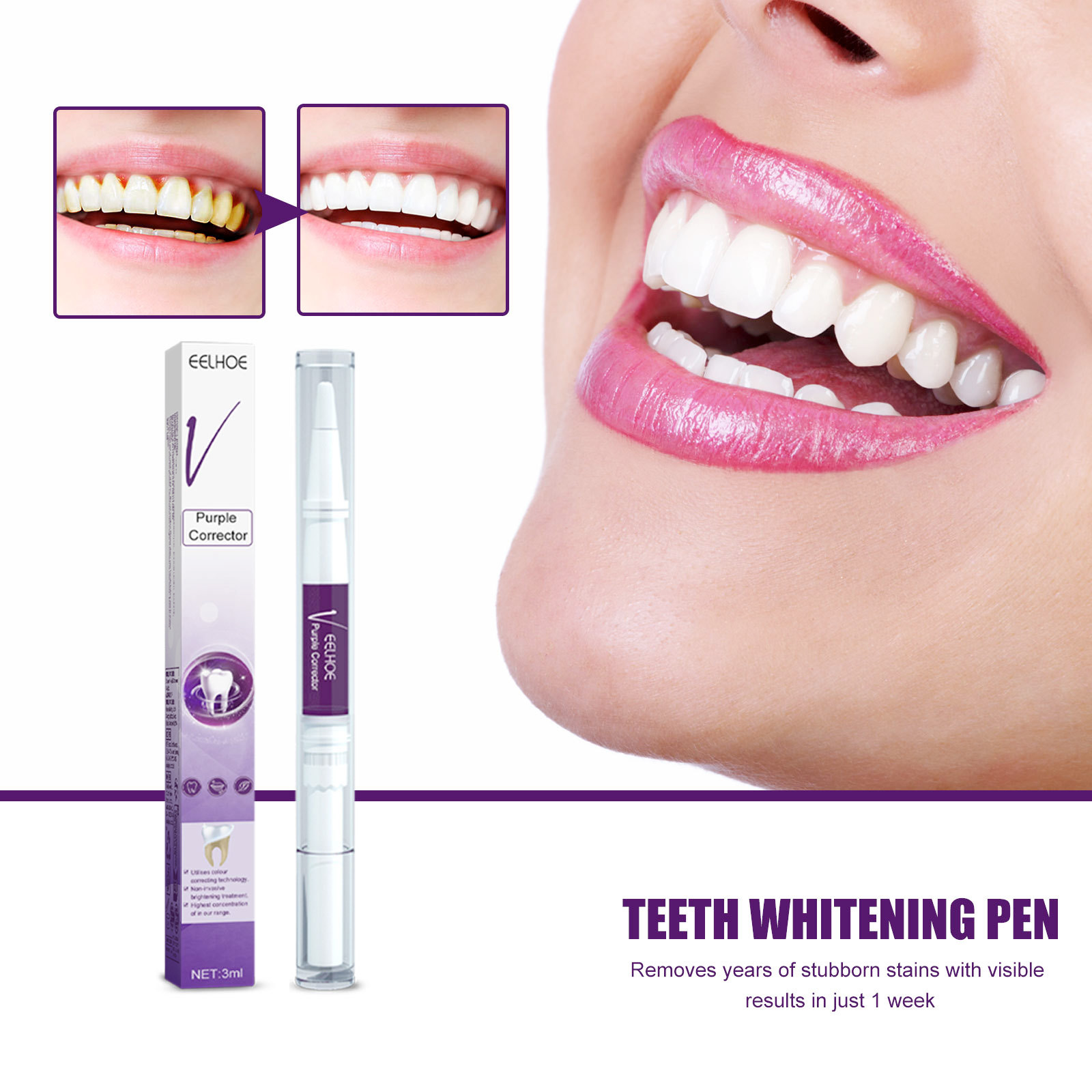 Whitening Pen Bleach - สีม่วงฟันไวท์เทนนิ่งยาสีฟันปากกาลบคราบจุลินทรีย์ทําความสะอาดสุขอนามัยในช่องปากฟอกสีฟันทันตกรรมเครื่องมือ Fresh Breath ฟัน Care