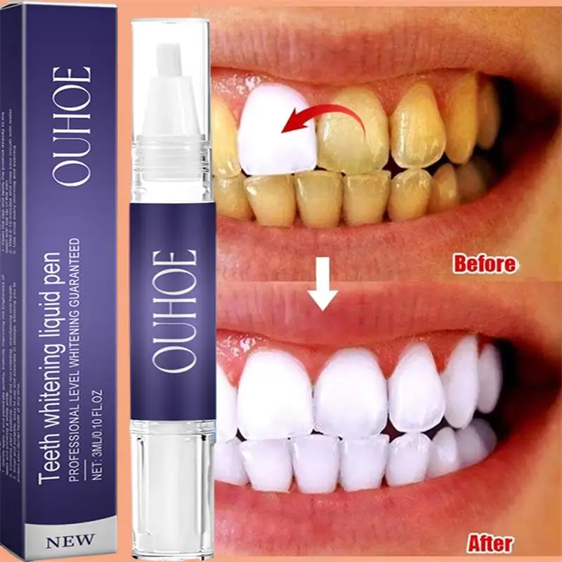 Whitening Pen Bleach - Fast ฟันไวท์เทนนิ่งยาสีฟันปากกาลบคราบจุลินทรีย์ทําความสะอาด Oral สุขอนามัยฟอกสีฟันทันตกรรมเครื่องมือ Fresh Breath