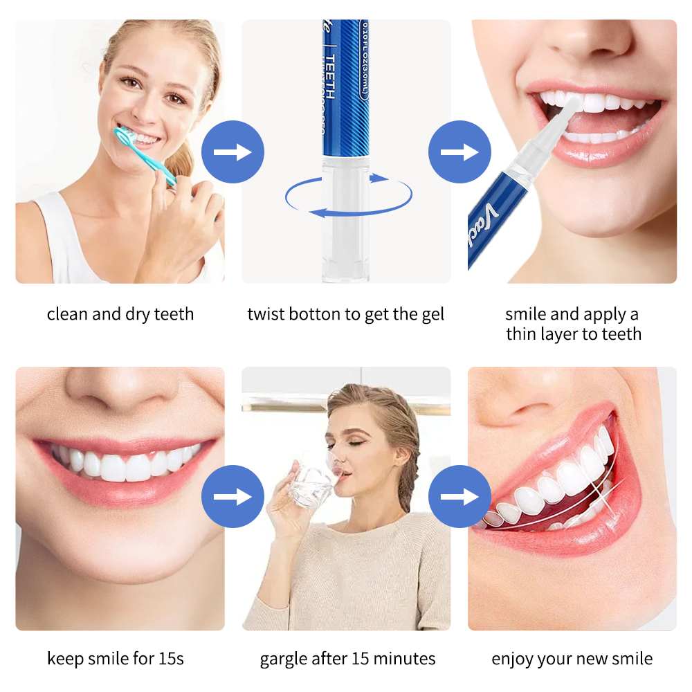 ปากกาฟอกสีฟันเจลฟอกสีฟันน้ำยาฟ - Whitening Pen Bleach บทวิจารณ์และราคา