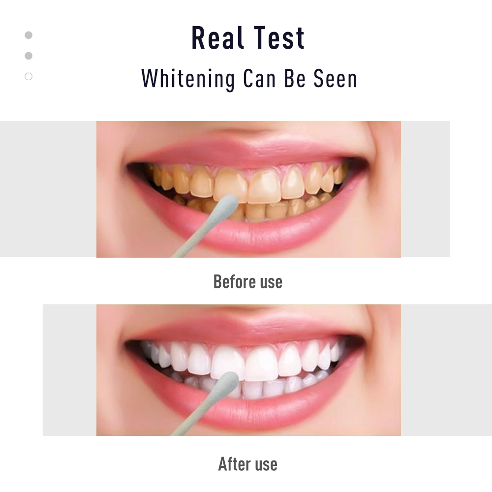 ชุดปากกาเจลสีขาวทำความสะอาดฟัน - Whitening Pen Bleach บทวิจารณ์และราคา