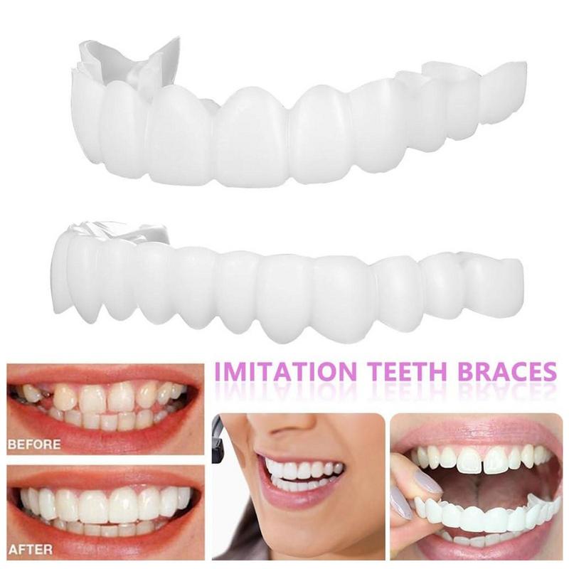 วีเนียร์ฟันแบบพิเศษสำหรับงานกี - Teeth Whitening For Photos บทวิจารณ์และราคา