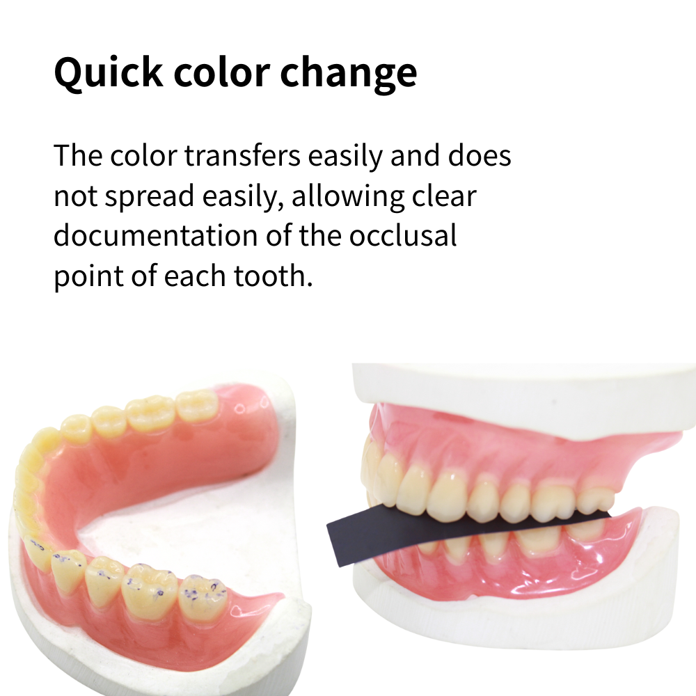 กระดาษเชื่อมฟัน AG 300 แผ่น/กล - Teeth Whitening Lab บทวิจารณ์และราคา