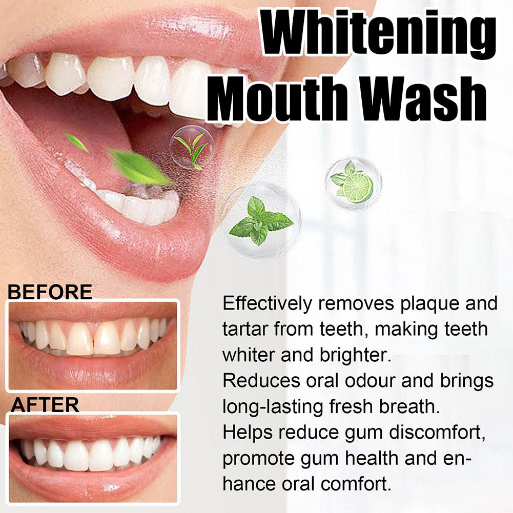 น้ำยาบ้วนปากมะพร้าวมิ้นท์ ปราศ - Teeth Whitening Oil Pulling บทวิจารณ์และราคา