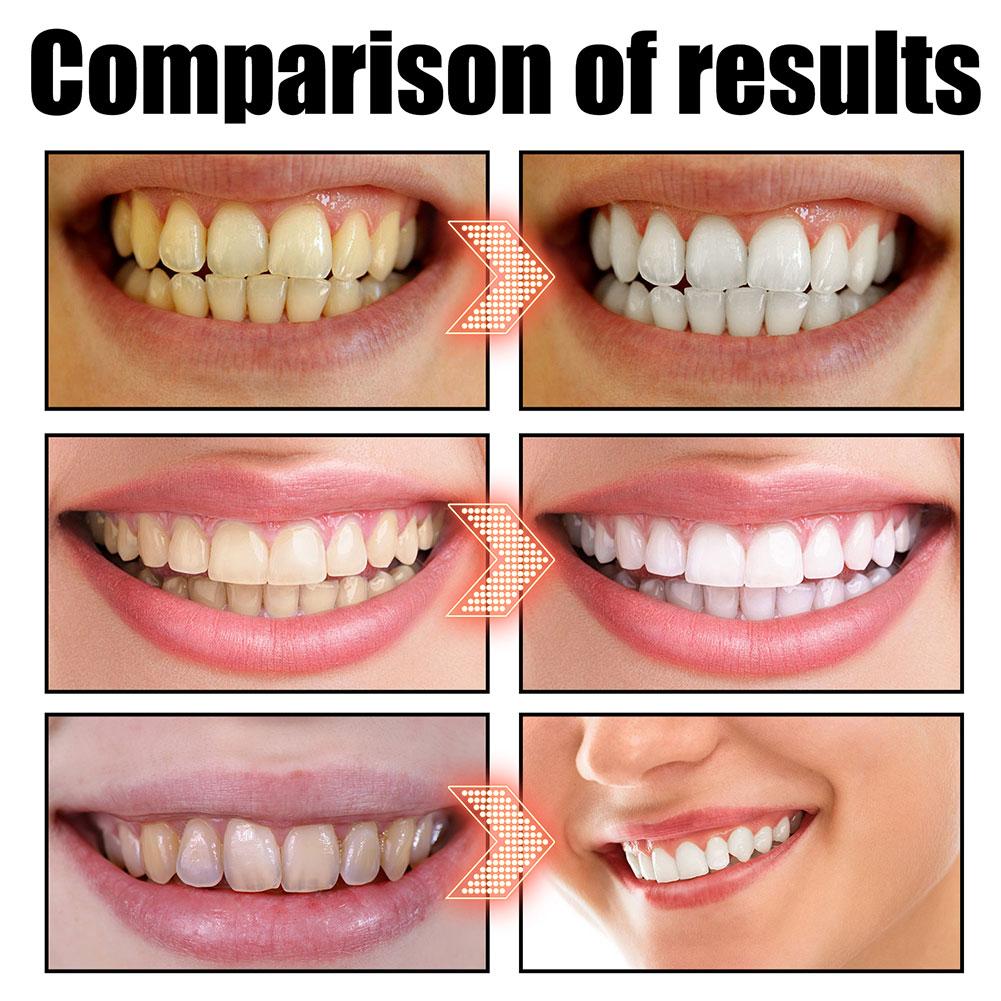 น้ำยาบ้วนปากมะพร้าวมิ้นท์ ปราศ - Teeth Whitening Oil Pulling บทวิจารณ์และราคา