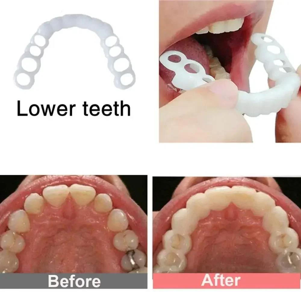 วีเนียร์ฟันสำหรับครอบครัวรุ่นใ - Teeth Whitening For Photos บทวิจารณ์และราคา