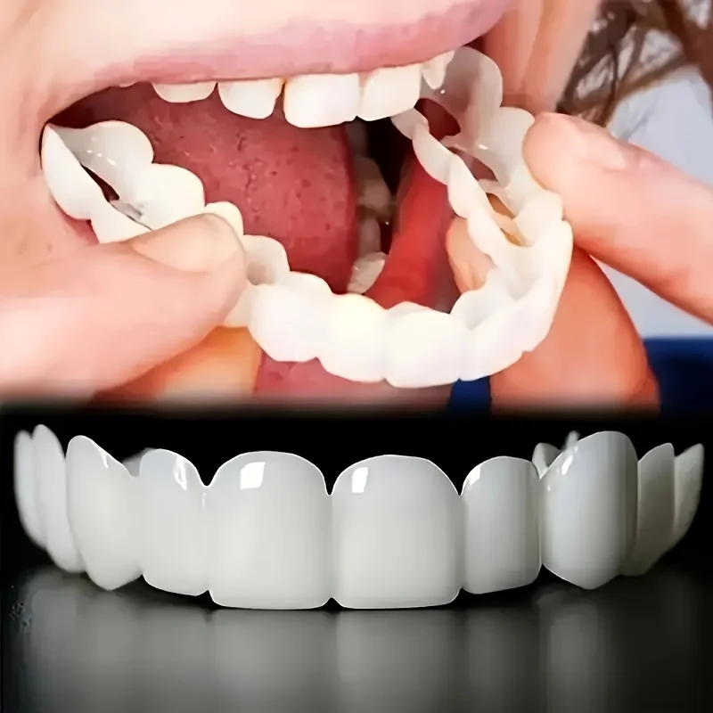 วีเนียร์ฟอกสีฟันแบบใช้ซ้ำได้ ค - Teeth Whitening Quick บทวิจารณ์และราคา