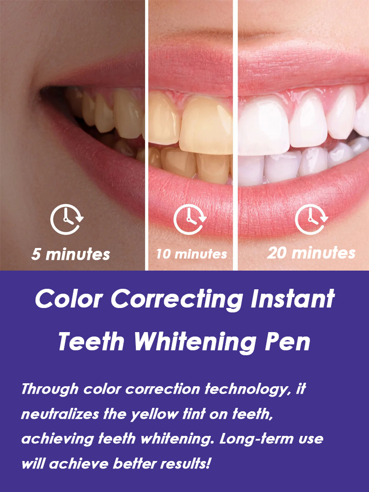 ปากกาฟอกสีฟัน ขจัดคราบพลัคได้อ - Whitening Pen Bleach บทวิจารณ์และราคา