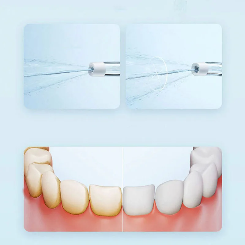 เครื่องฉีดน้ำทำความสะอาดช่องปา - Teeth Whitening Quick บทวิจารณ์และราคา