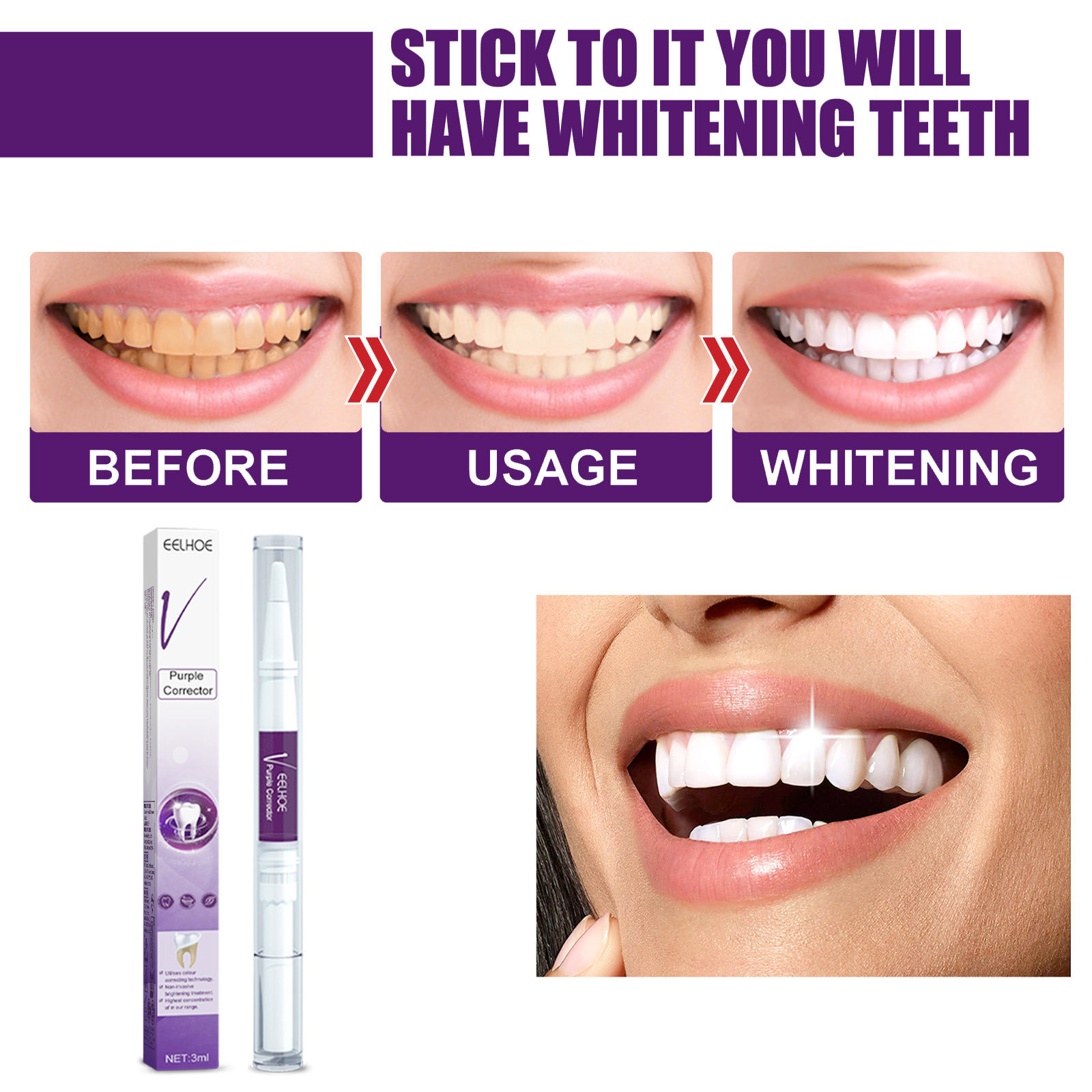 สีม่วงฟันไวท์เทนนิ่งยาสีฟันปาก - Whitening Pen Bleach บทวิจารณ์และราคา