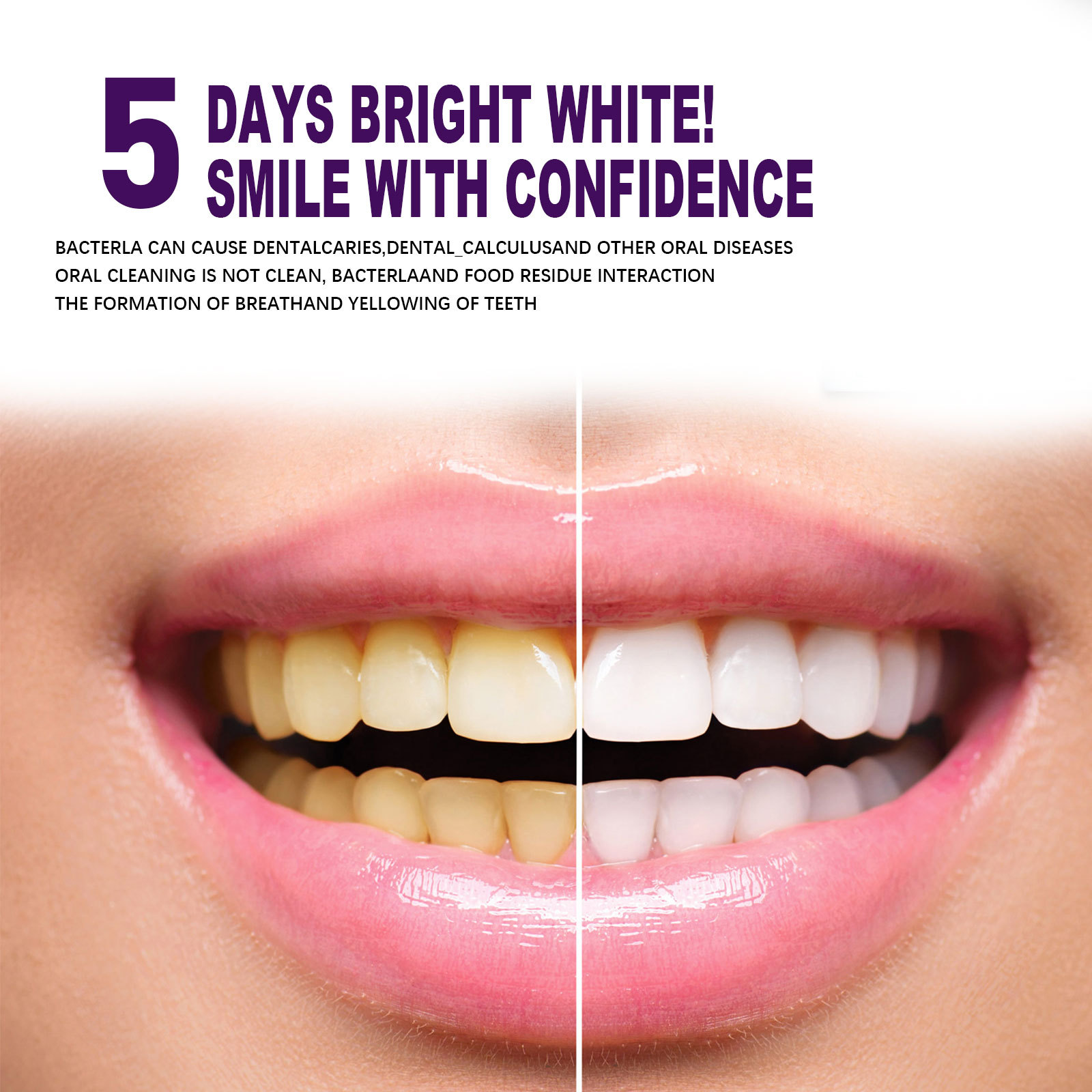 สีม่วงฟันไวท์เทนนิ่งยาสีฟันปาก - Whitening Pen Bleach บทวิจารณ์และราคา