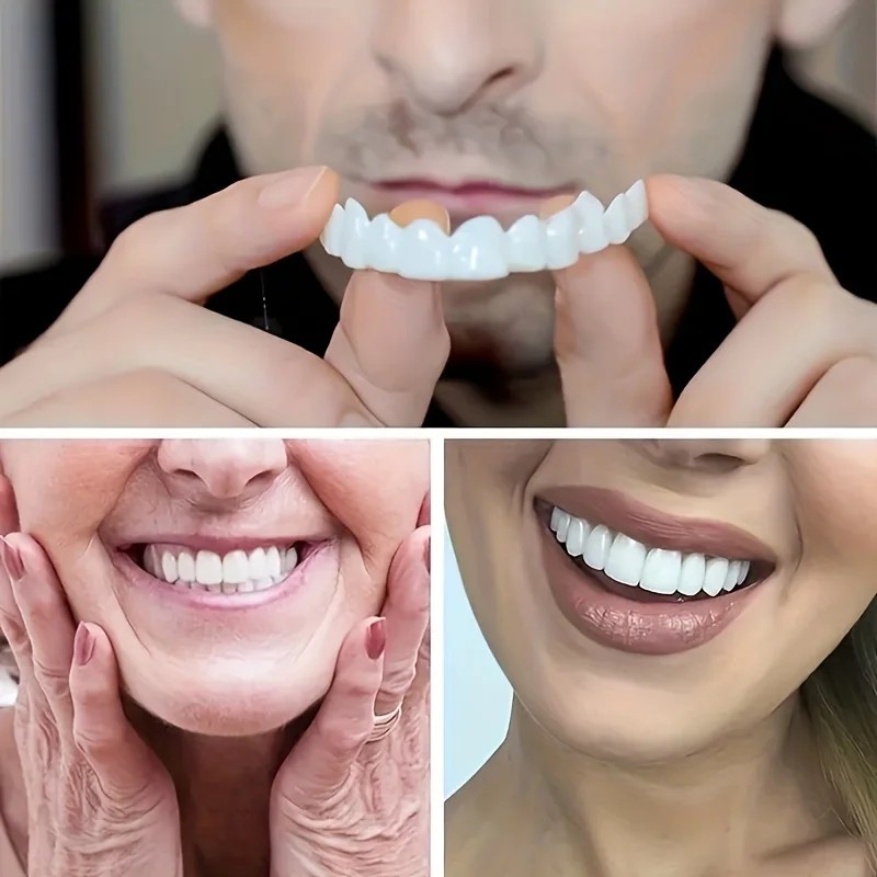 วีเนียร์ฟันแบบพิเศษสำหรับงานกี - Teeth Whitening For Photos บทวิจารณ์และราคา