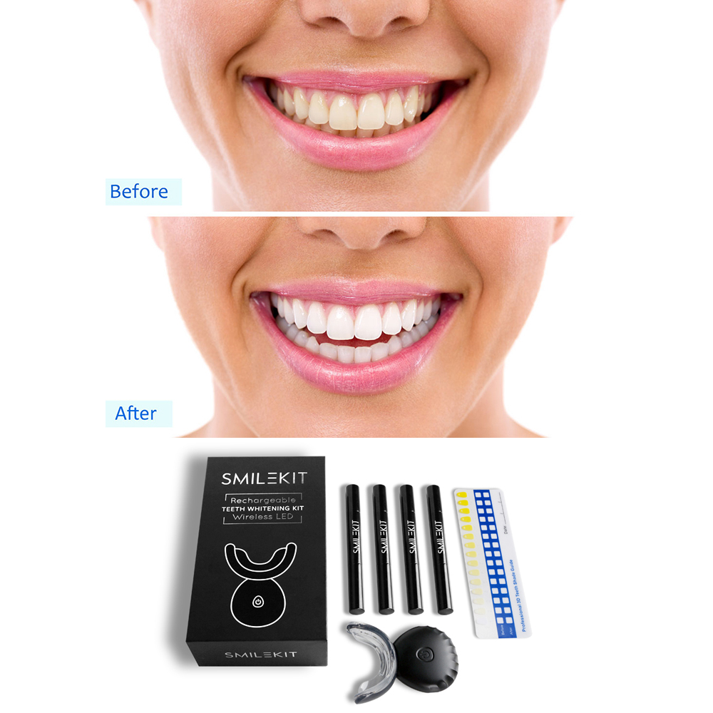 ใหม่ไฟฟ้าฟอกสีฟัน LED บ้านไร้ส - Teeth Whitening Home Kit บทวิจารณ์และราคา
