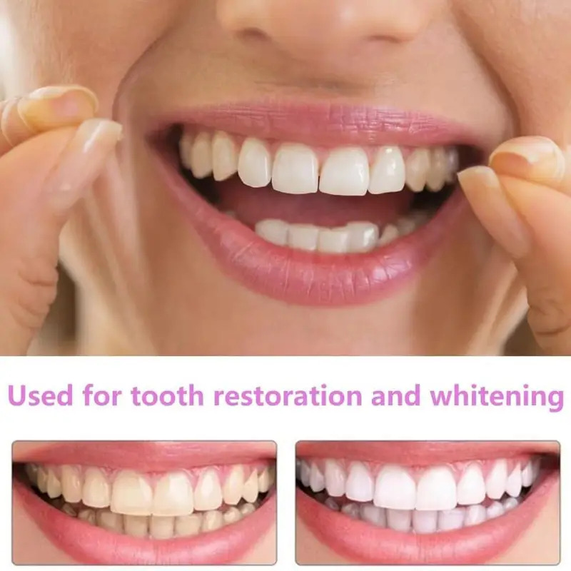 วีเนียร์ฟันสำหรับเจ้าของสัตว์เ - Teeth Whitening For Photos บทวิจารณ์และราคา