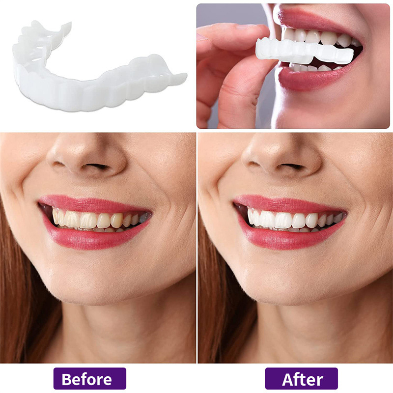 วีเนียร์ฟันแบบพิเศษสำหรับวันหย - Teeth Whitening For Photos บทวิจารณ์และราคา