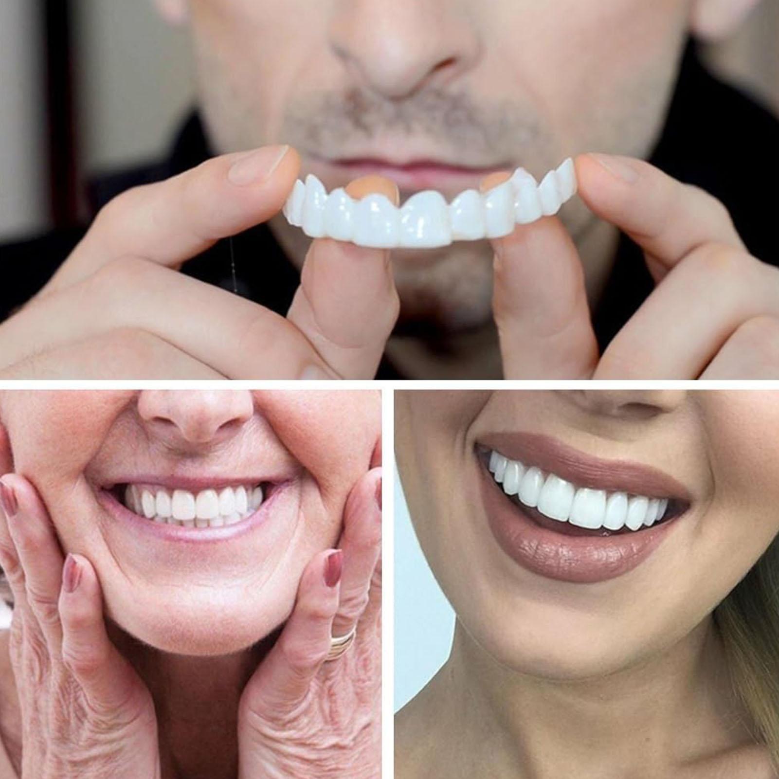 วีเนียร์ฟันแบบใหม่สำหรับคนขี้อ - Teeth Whitening For Photos บทวิจารณ์และราคา