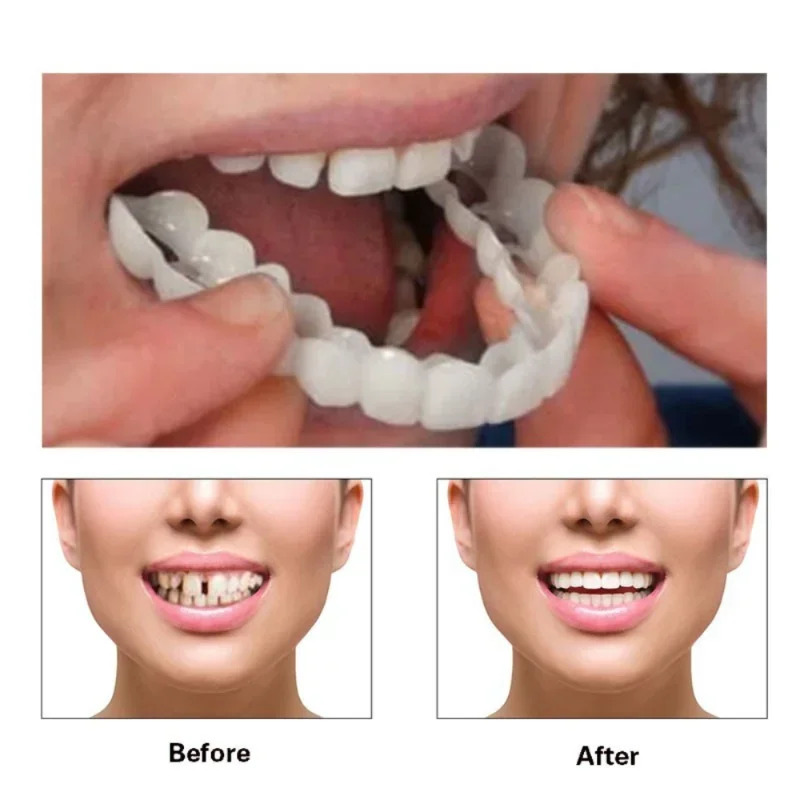 วีเนียร์ฟันยิ้มสวยสำหรับภาพครอ - Teeth Whitening For Photos บทวิจารณ์และราคา