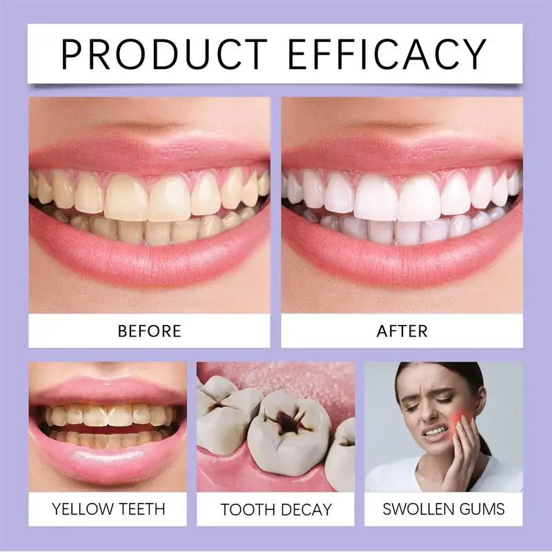 หัวขัดฟันอัลตราโซนิก P4 สำหรับ - Teeth Whitening Tips บทวิจารณ์และราคา
