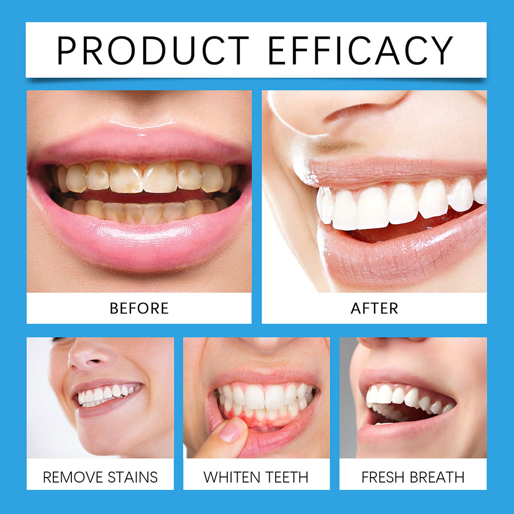 ผงขจัดคราบฟันระดับมืออาชีพ สำห - Teeth Whitening For Photos บทวิจารณ์และราคา